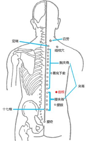 地根穴|根除结节——痞根穴